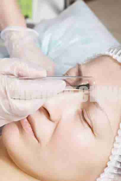 Benefits of Leech Therapy for Facial Rejuvenation