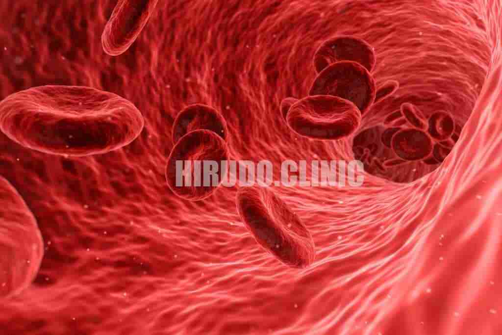 Blood Thinning