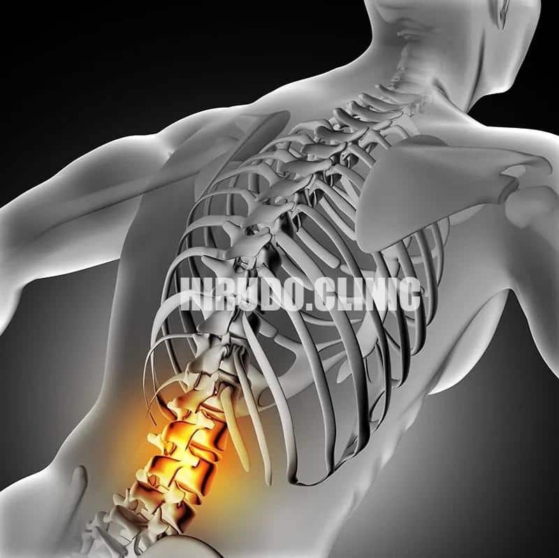 Quick and Effective Pain Relief with Leech Therapy