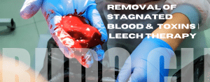 LEECHES NATURALLY SECRETE ENZYMES
