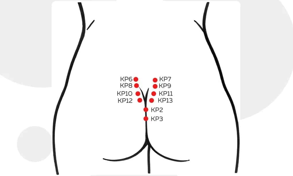 Hirudotherapy for Hemorrhoid Treatment in London