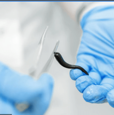 Почему стоит выбрать наши услуги мобильной пиявкотерапии? Why Choose Our Mobile Leech Therapy Services?