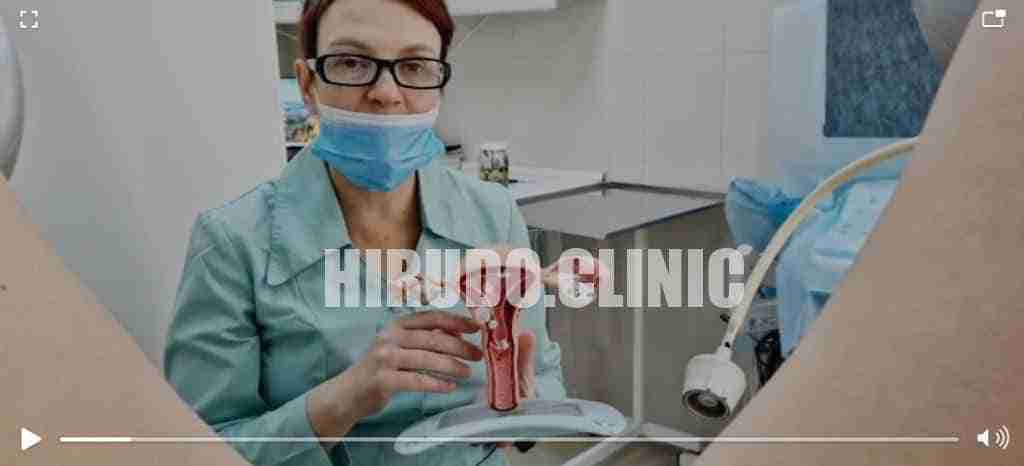 Intravaginal Hirudotherapy: Intensive 3-Day Online Course (leech therapy for women’s health) Intravaginal Hirudotherapy: Intensive 3-Day Online Course (leech therapy for women’s health)