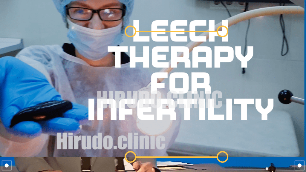 UntitledLeech Therapy for Infertility Bottom line: Intravaginal leech therapy is powerful yet technique-sensitive. We teach it because women deserve the choice—and we make that choice safe.