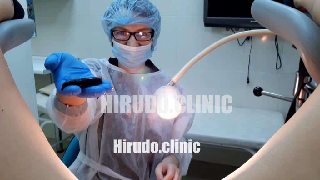 When applied correctly, medicinal leeches release biologically active substances like hirudin and anti-inflammatory enzymes into the bloodstream, which can help reduce local swelling, relieve pelvic congestion, and improve microcirculation.