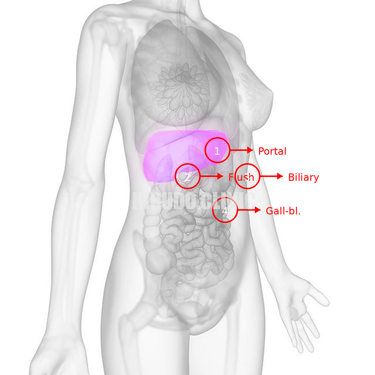 Liver‑detox with leech therapy 
