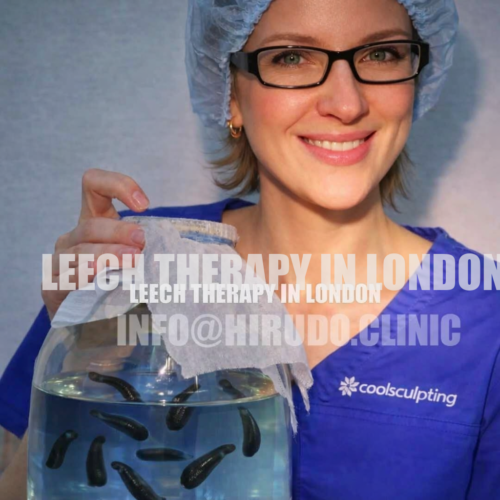 Hirudo.Clinic offers leech therapy in London (hirudotherapy) with single-use medical leeches (never reused) and strict hygiene standards.