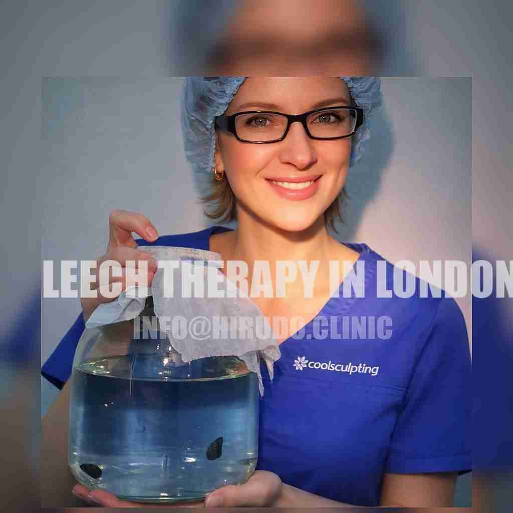 Hirudo Clinic practitioner holding a jar of medicinal leeches for online hirudotherapy course