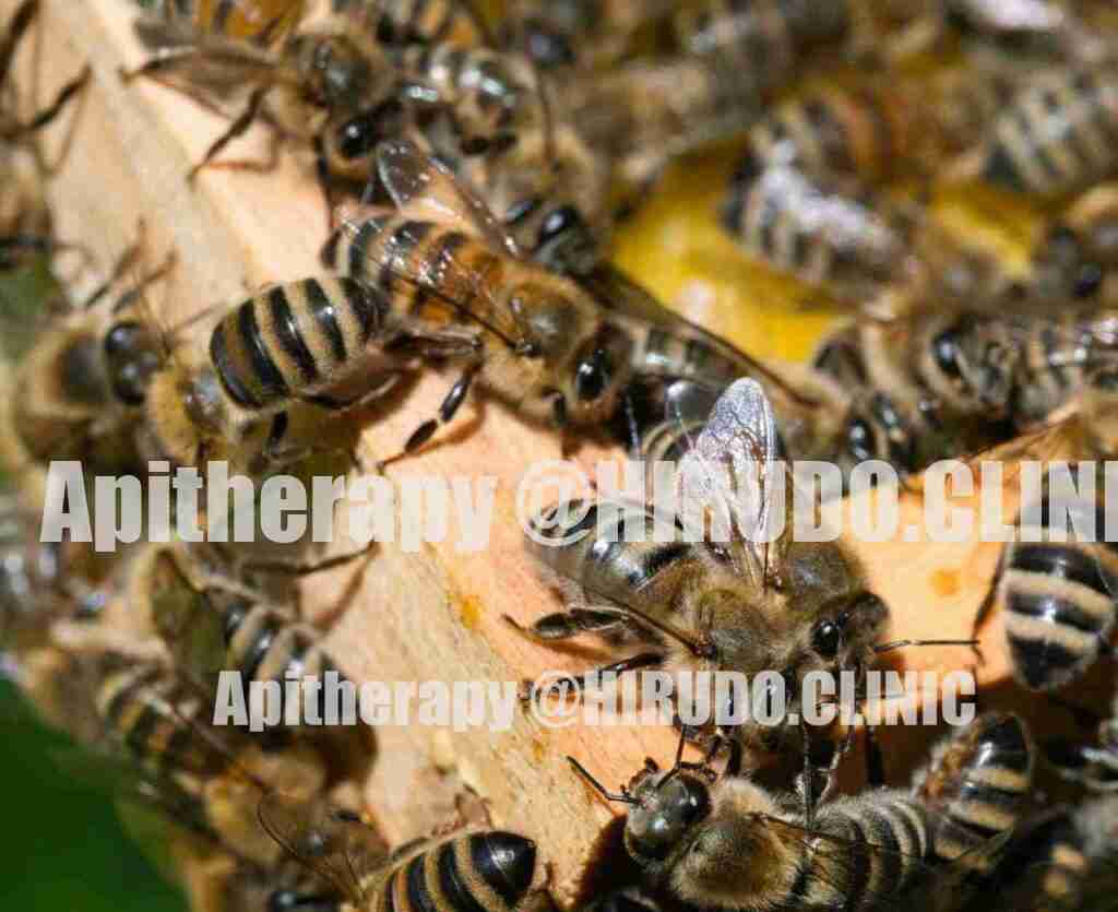 We currently offer the live-hive bee venom experience only in Crete, Greece.