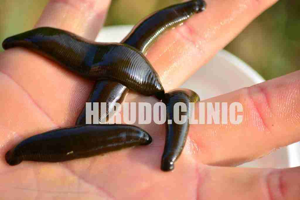 leech, medical leech, angler, bait, leech, leech, leech, leech, leech